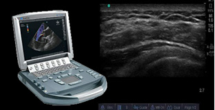 Ultrasound